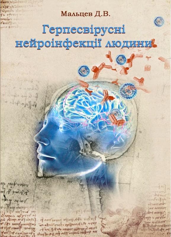 Герпесвірусні нейроінфекції людини
